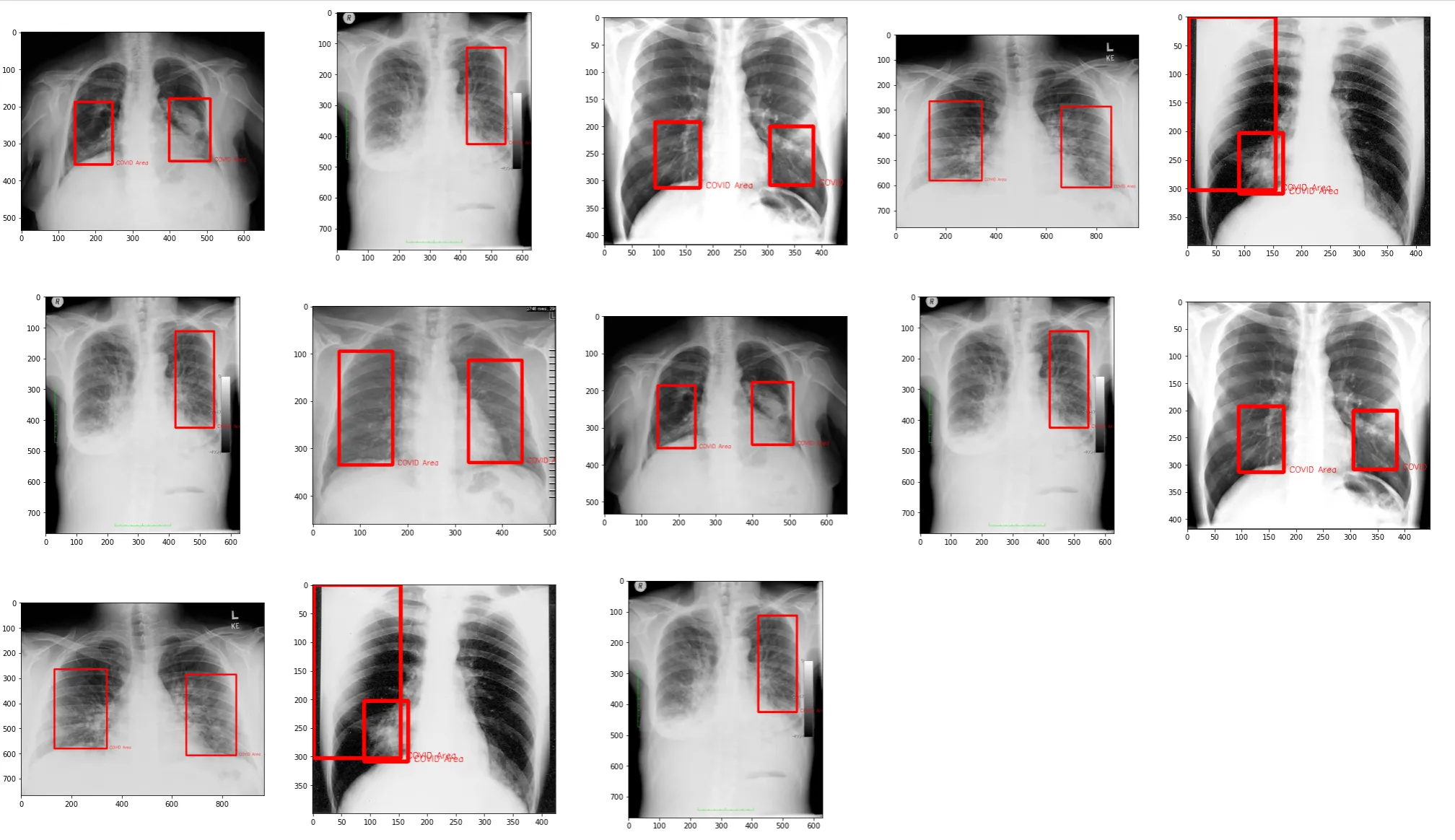 Clasificación y detección de Covid-19 en radiografías de tórax usando Deep Learning e IBM Visual Recognition